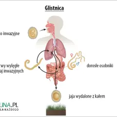 Glistnica u dziecka: Kluczowe objawy, których nie możesz przegapić